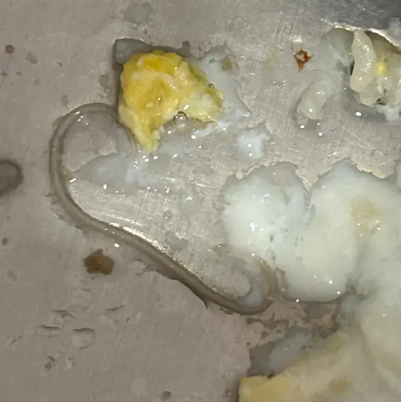 加拿大Costco鸡蛋发现寄生虫? 这锅蛋炒饭还能吃么? 大批网友破防!