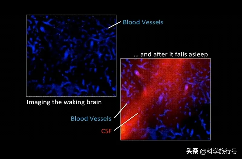 科学家最新发现:大脑会在睡眠中自我清洁 速度惊人!