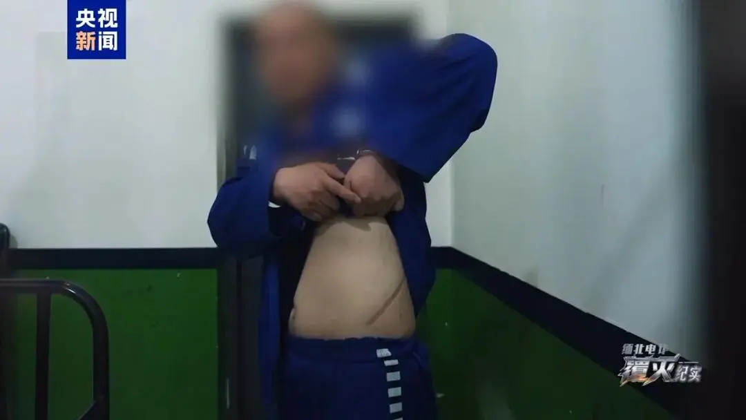 缅北电诈回流人员自述被割肾亲身经历：不要说肾了，锯条腿都愿意