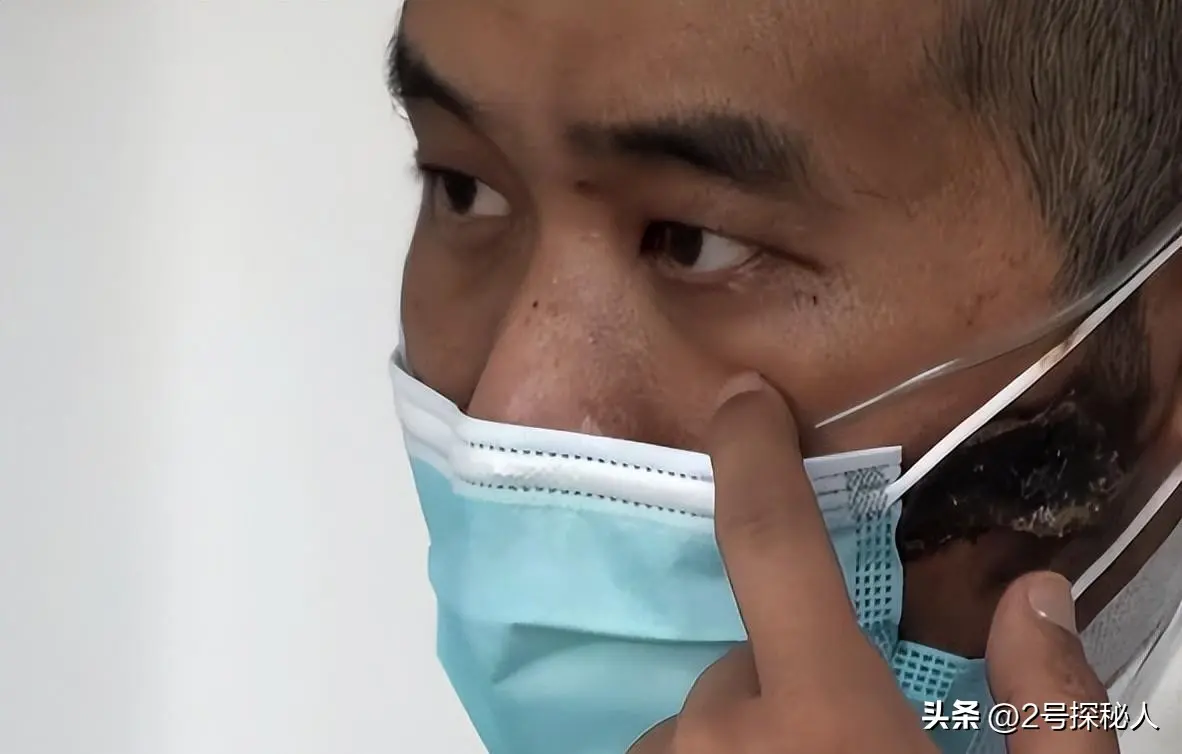武汉首批新冠幸存者，如今怎么样了？
