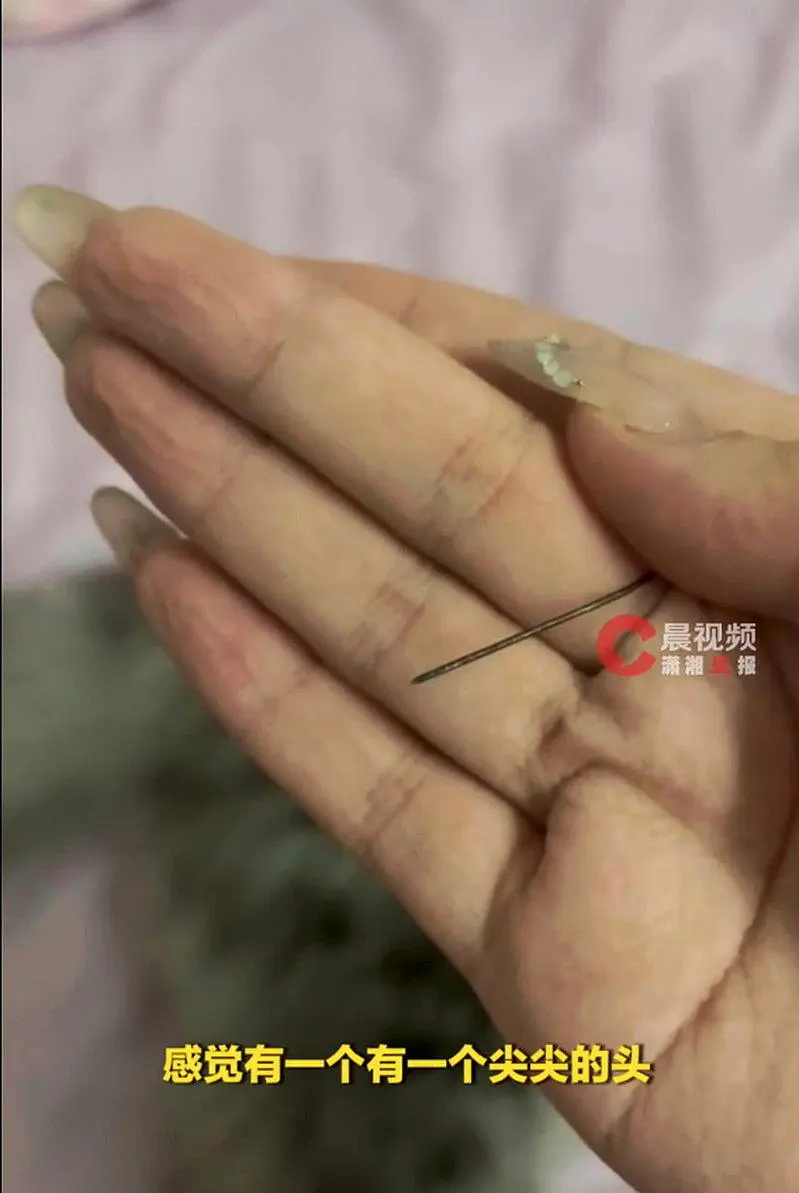 温州女左臀痛1个月 自己动手挤出5公分生锈针头 来源成谜