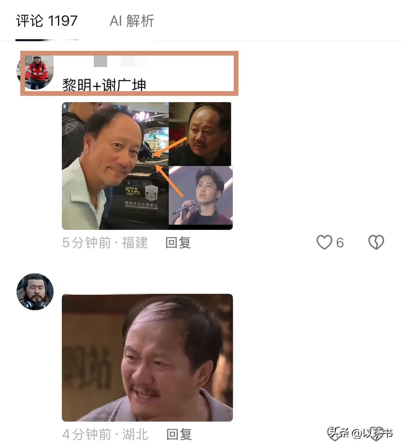 54岁张德培 曾做过洗发水广告的头发秃了