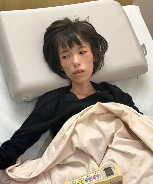 日本16岁少女遭拘留18日，患PTSD暴瘦至20公斤后身亡